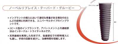 リプレイス　グルービー040.jpg